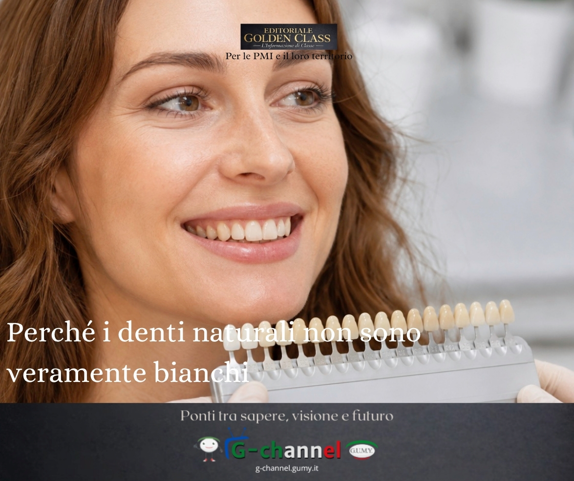 Perché i denti naturali non sono veramente bianchi